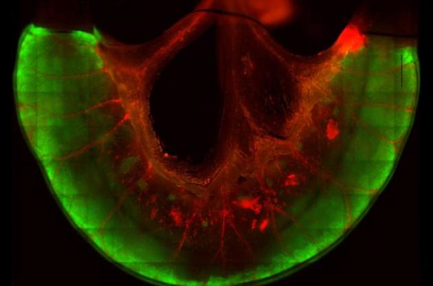 Фрагменты кишечника человека вырастили в полости тела крысы