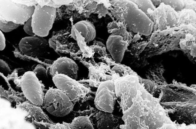 Вчені простежили шляхи міграції чуми в Європі кам'яної доби