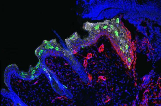 Шкіра зберігає &quot;пам&#039;ять&quot; про загоєні рани