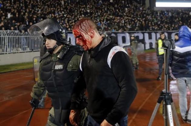 Фанаты "Партизана" устроили кровавую драку во время матча