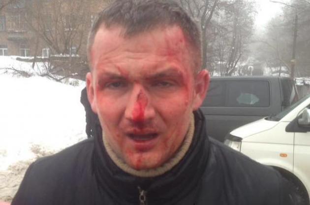 В Киеве избили народного депутата Левченко