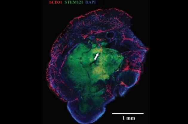 Вчені виростили в лабораторії міні-мозок