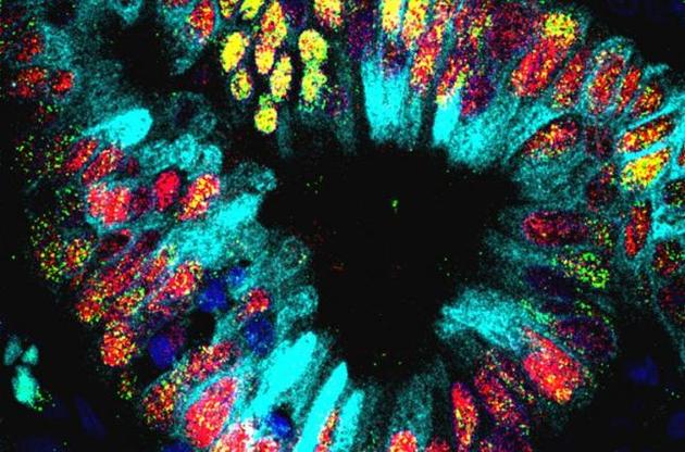 Ученые обнаружили микроскопический желудок внутри опухоли легких