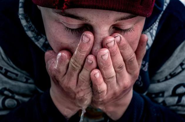 Алексей Агапин, 14 лет, с. Воздвиженка, Донецкая обл. Алексей лишился трех пальцев из-за взрыва детонатора из ручной гранаты, который он нашел на улице. &copy;UNICEF/Ukraine/UN0150855/Gilbertson