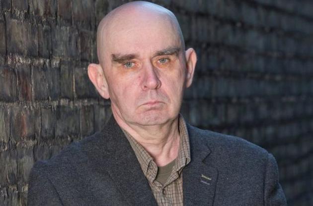 Карпічков після нападу на нього в 2007 році втратив понад 30 кг ваги і повністю облисів