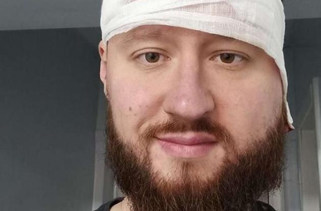 Кримінальники, які побили Булаха, зізналися, що виконували замовлення