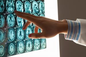 У полоні контузії