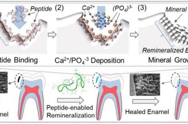 Разработана смесь, которая способна восстановить зубную эмаль