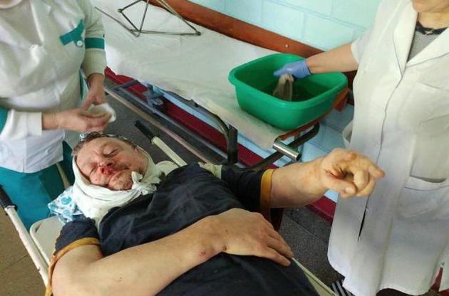 Вооруженные злоумышленники ворвались в дом Олега Филипаса и переломали ему обе руки