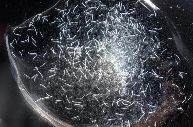 Spirostomum ambiguum оказалось самым быстрым существом на Земле