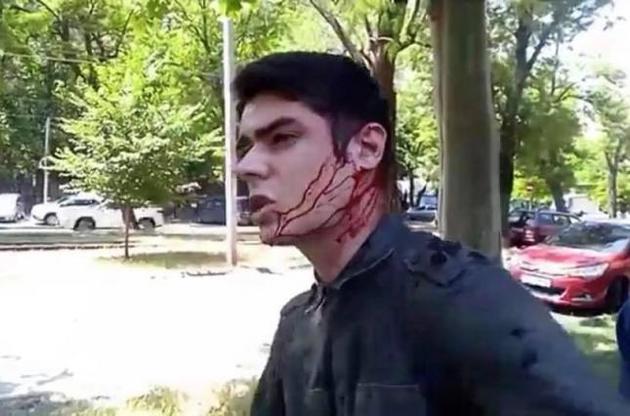 В Одессе ранили ножом лидера местного Автомайдана Устименко