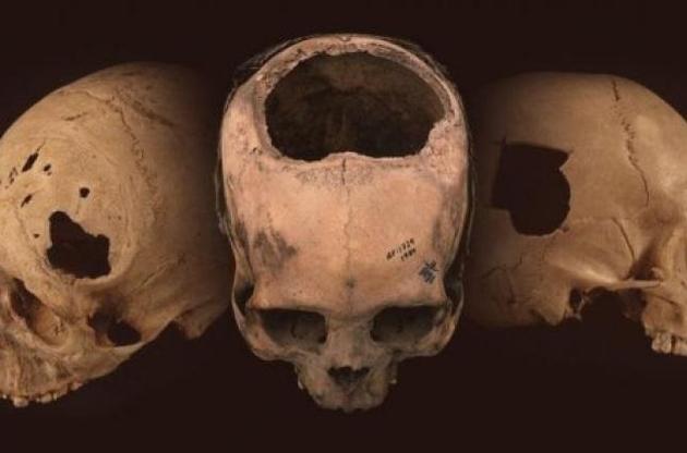 Середньовічні інки виявилися майстрами трепанації