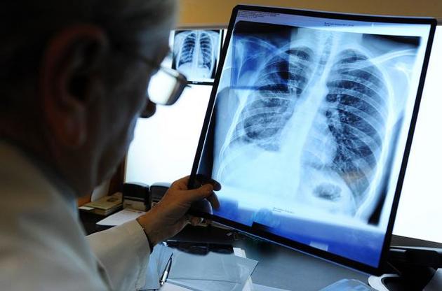 В Донбассе возросло количество больных туберкулезом