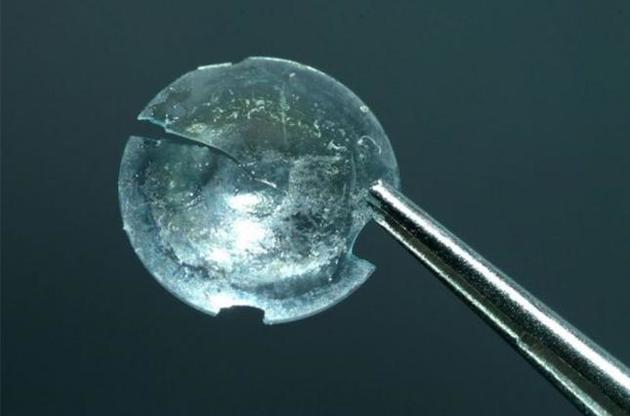 Линза находилась в глазу британки 28 лет