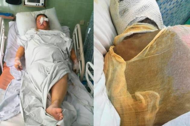 Друзья Гандзюк возмущены действиями полицейских