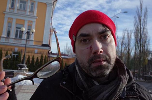 У Климкина отреагировали на нападение на канадского журналиста в Киеве