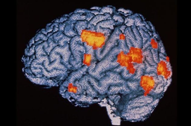 Вчені виростили в лабораторії "міні-мозок", схожий на мозок недоношеної дитини