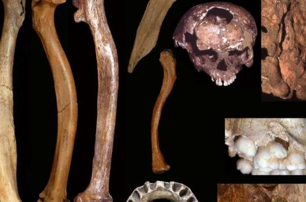 Древние люди страдали от аномалий развития