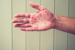 Территория кори