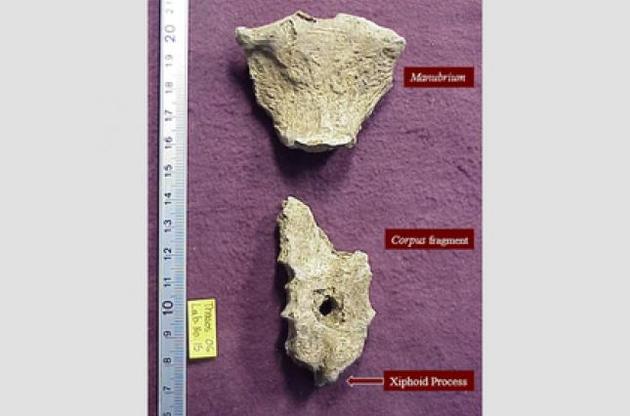 В груди чоловіка встромили спис