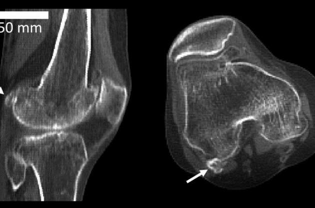 Фабелла считалась утерянной в ходе эволюции