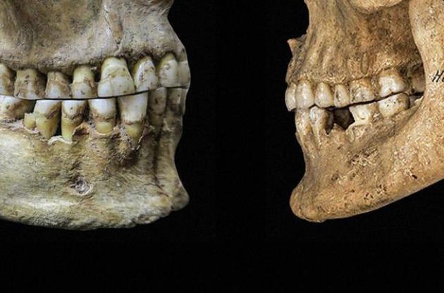 Вимову звуків "ф" і "в" пов'язали з типом прикусу