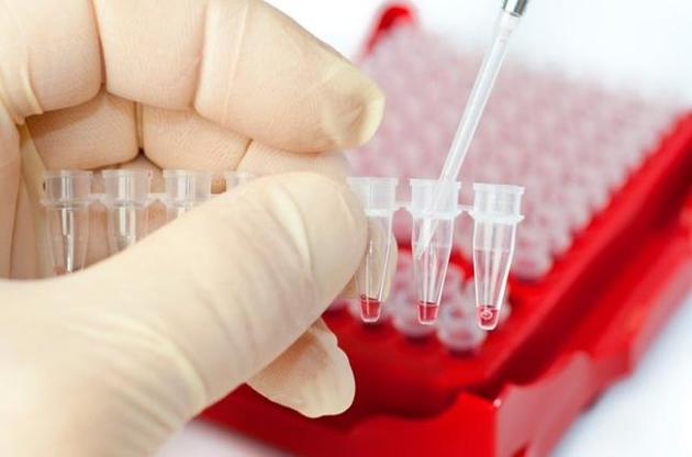 Не кровь и не моча: Супрун рассказала, в каком материале искать наркотики