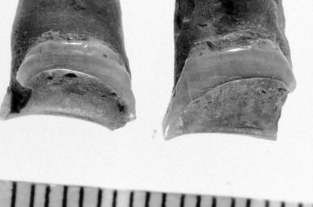 Зуби жінки вказали на її професію