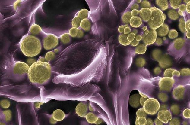 Грибы вырабатывают золото в чистом виде