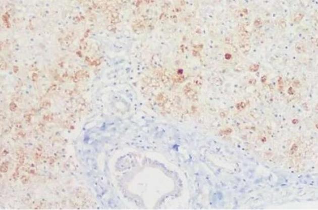 Вирус возник в 1980 году на севере Бразилии