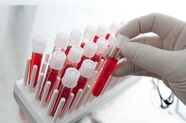 Новий аналіз крові дозволяє передбачити смерть протягом найближчих 10 років