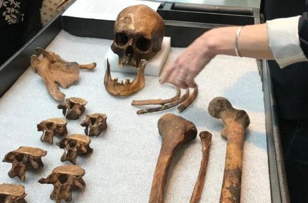 "Вампір" помер від туберкульозу на початку 1800-х років