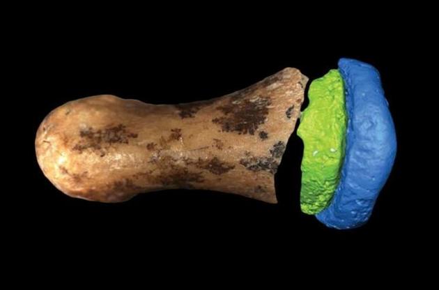 Палець належав дівчинці-підлітку