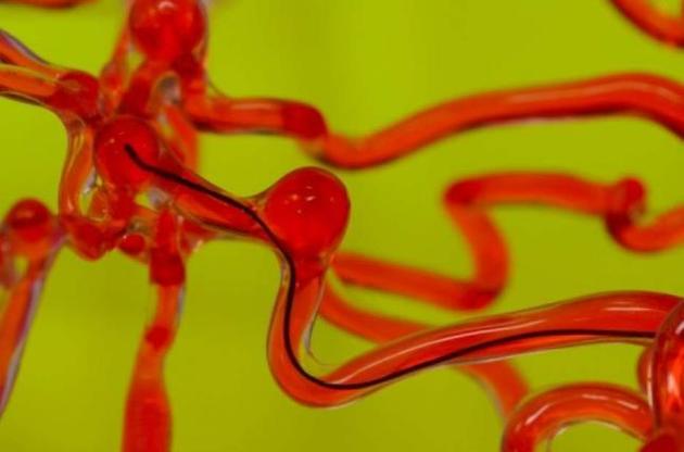 Робот может маневрировать по артериям