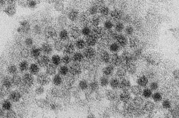 Ученые открыли необычный вирус