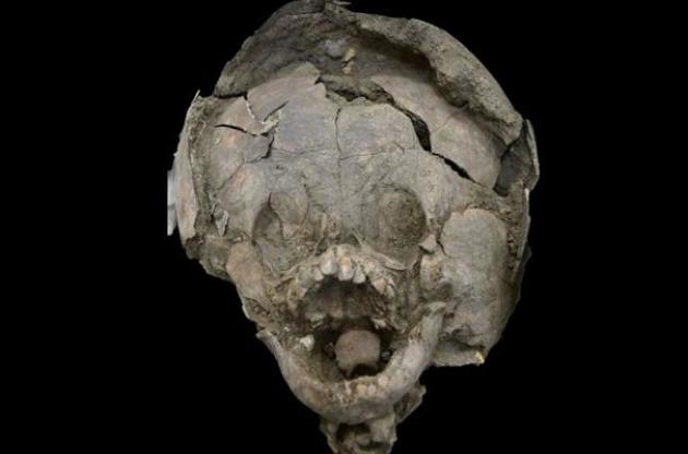 Археологи обнаружили в Эквадоре захоронения детей в "шлемах" из черепов