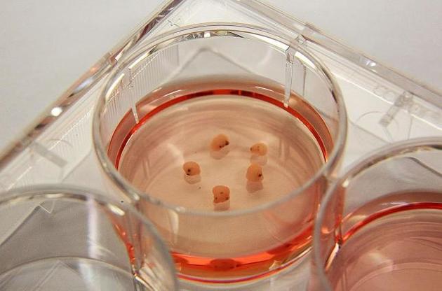 &quot;Мини-мозги&quot; могут испытывать &quot;бесконечный ужас&quot;, находясь вне тела