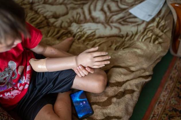 Потерпілі часто не мають постійного доступу до медичної, психологічної допомоги та комплексної реабілітації