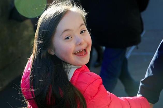 Вченим дізналися, як виправити розумову відсталість при синдромі Дауна