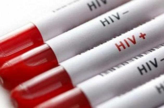 Вчені розповіли про те, як ВІЛ набуває стійкість до ліків