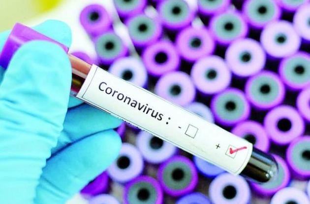 Україна створила власний діагностичний тест на коронавірус — джерело