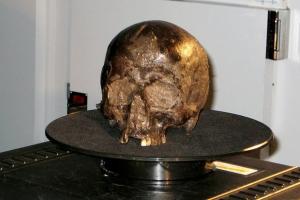 Вчені розповіли, як міг зберегтися один з найстаріших мозків людини