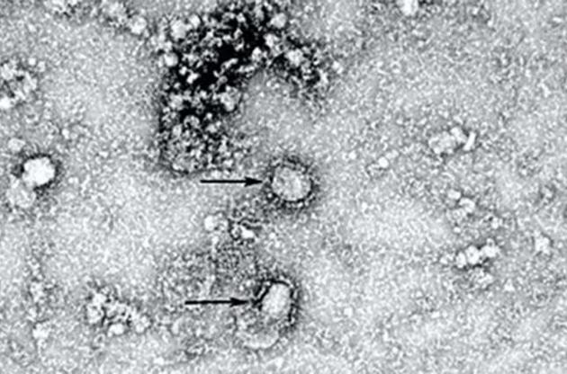 В Китае опубликовали снимок нового коронавируса