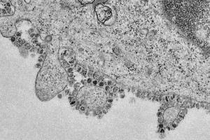 Вчені визначили механізм проникнення нового коронавіруса в клітину