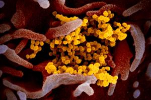 Коронавирус в мире: 77 тысяч случаев заболевания, умерло 2 464 человека