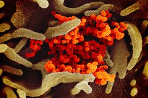 Ученые опубликовали новые снимки китайского коронавируса под микроскопом