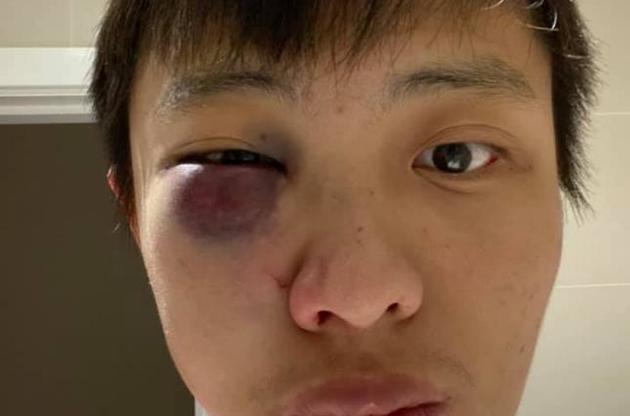 Азиатского студента в Лондоне избили "из-за коронавируса"