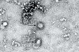 В РФ зафиксировали первые случаи заражения коронавирусом из Китая