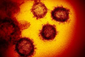 Новий коронавірус може жити на одязі та інших предметах більше тижня – вчені