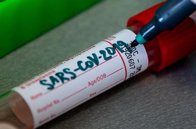 На стадіоні, загальна кількість місць в якому дорівнює 45 тис., буде розміщено 200 лікарняних ліжок